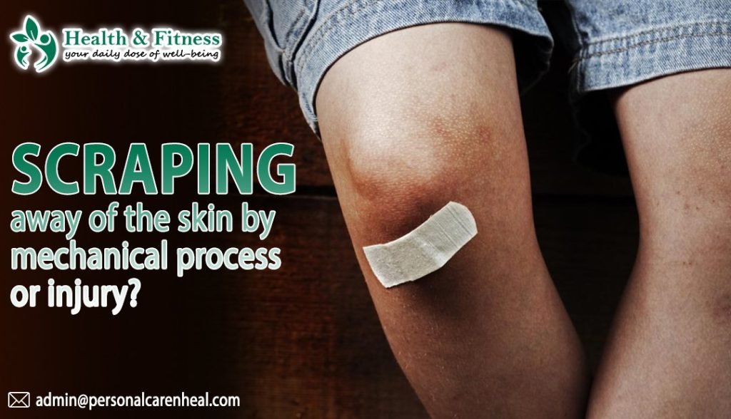 Scraping away of the skin by mechanical process or injury