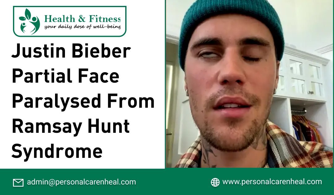 Justin Bieber Partial Face Paralysed