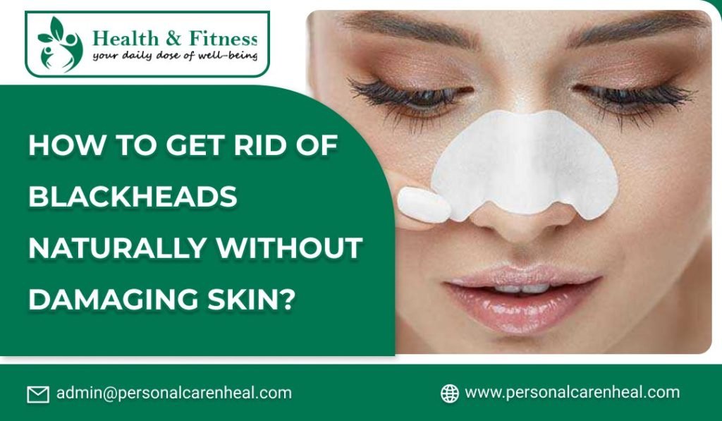 Get Rid of Blackheads Naturally