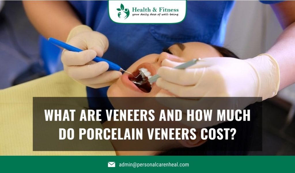 What is Veneers