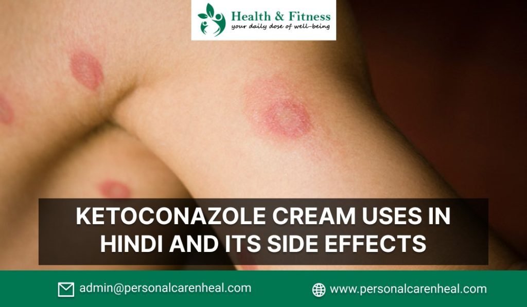 Ketoconazole Cream Uses in Hindi