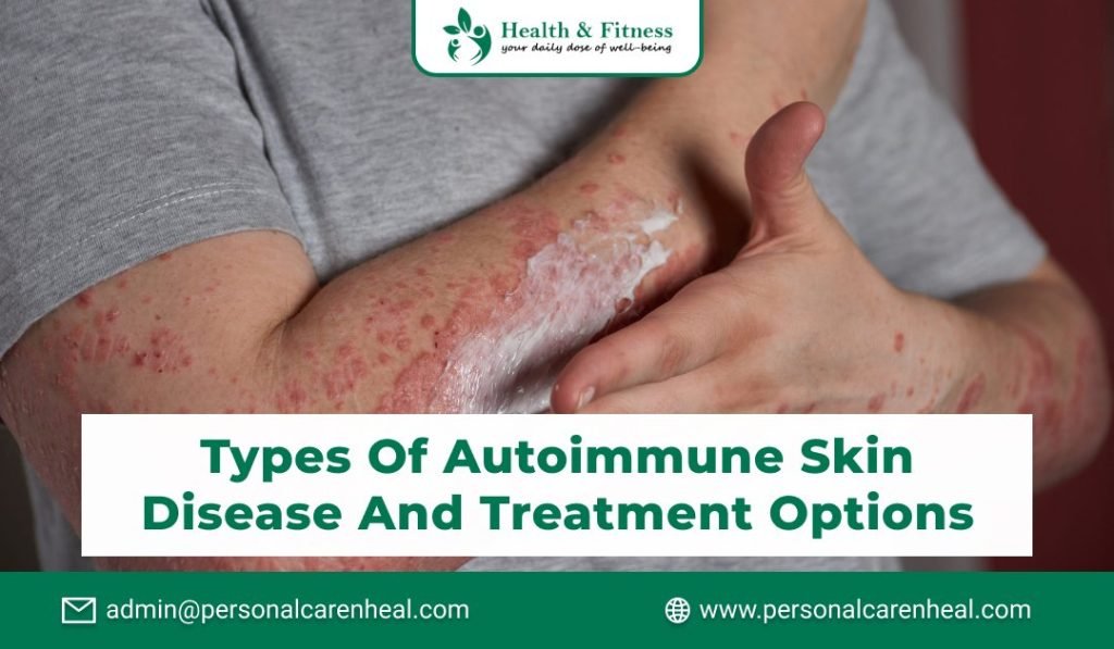 Types of Autoimmune Skin Disease and Treatment Options