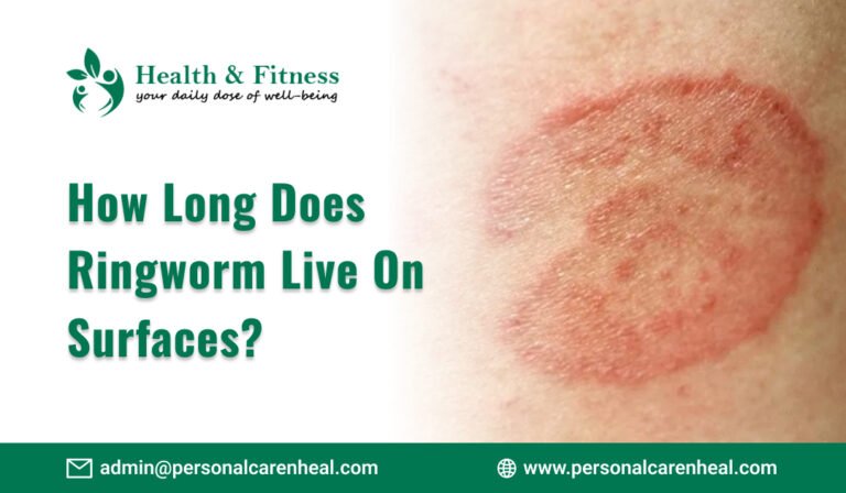 How Long Does Ringworm Live On Surfaces